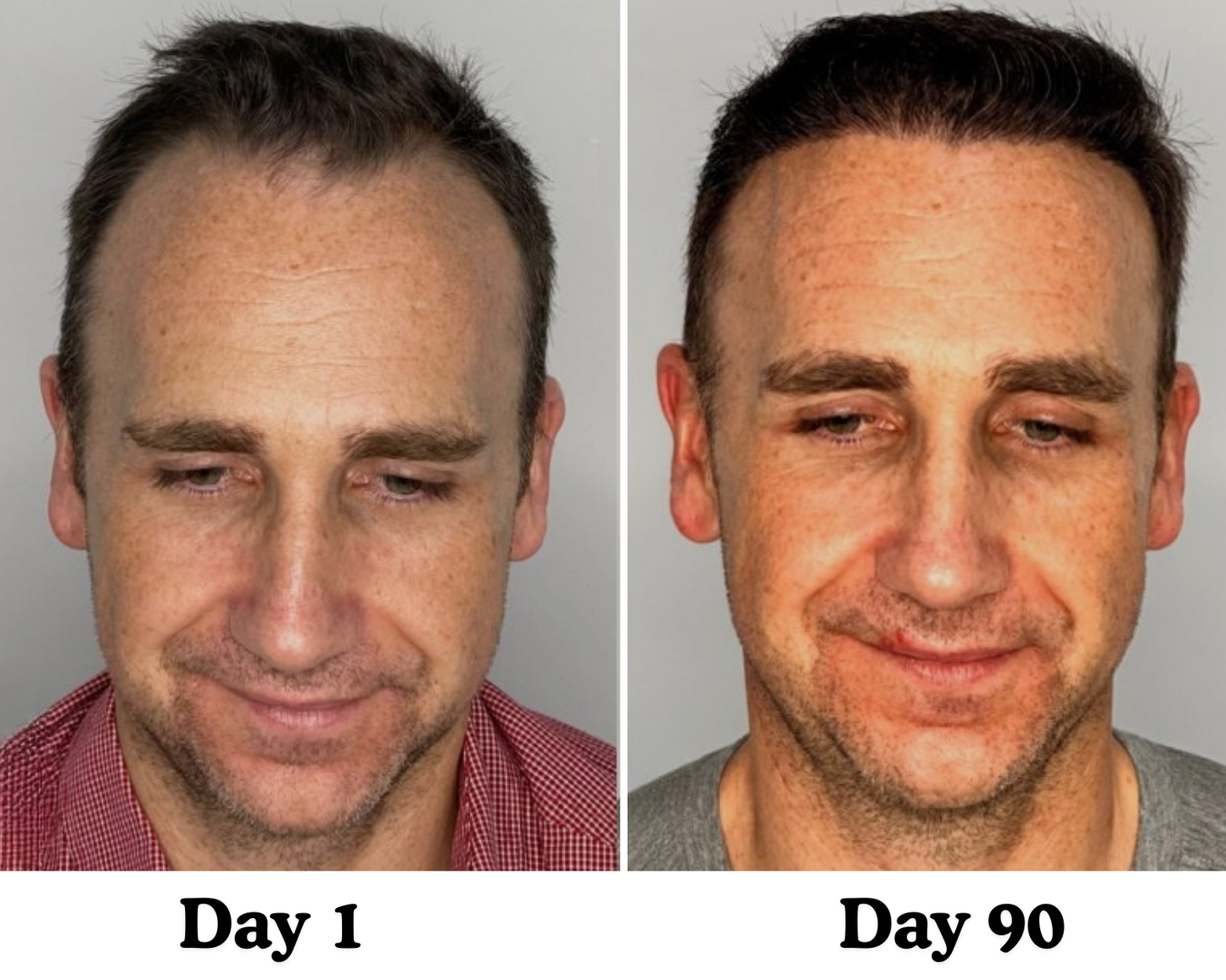 Pumpkin Seed Hair Restore