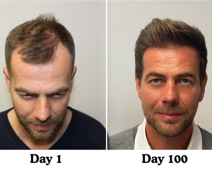 Pumpkin Seed Hair Restore